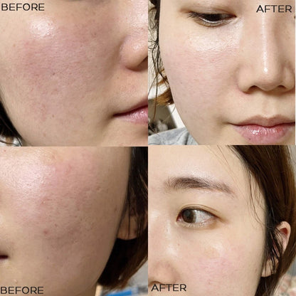 Medi-Peel Bio-intense Glutathione White Cream