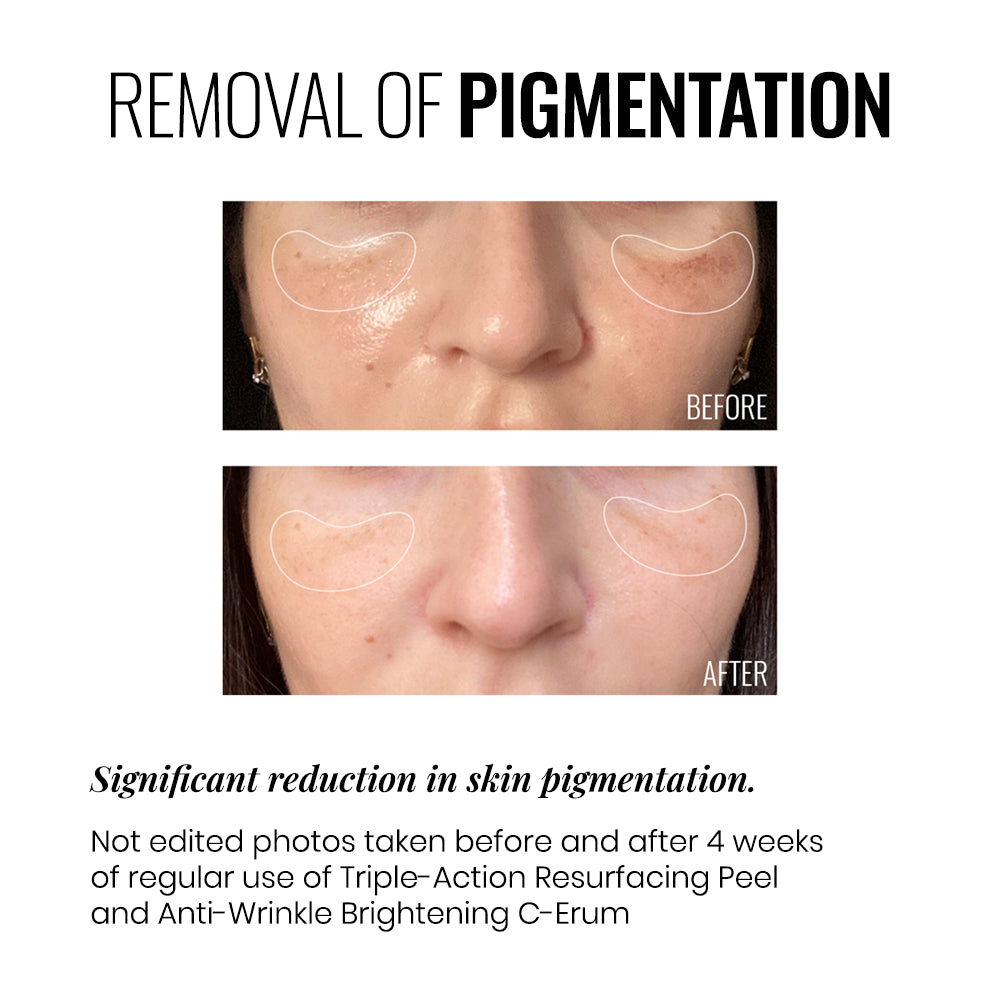 TRIPLE ACTION RESURFACING PEEL INSTYTUTUM